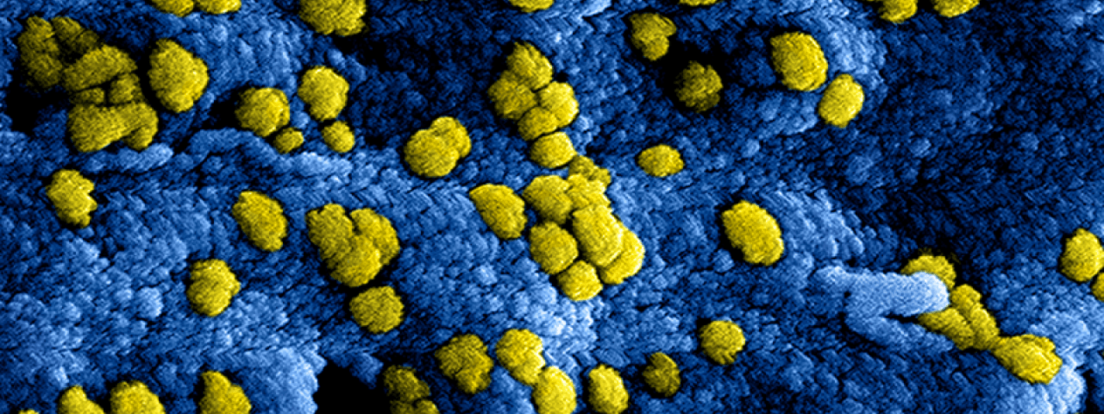 Microscopische weergave van het coronavirus